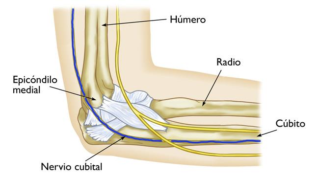 El nervio cubital pasa detrás del epicóndilo medial en la parte interior del codo. 