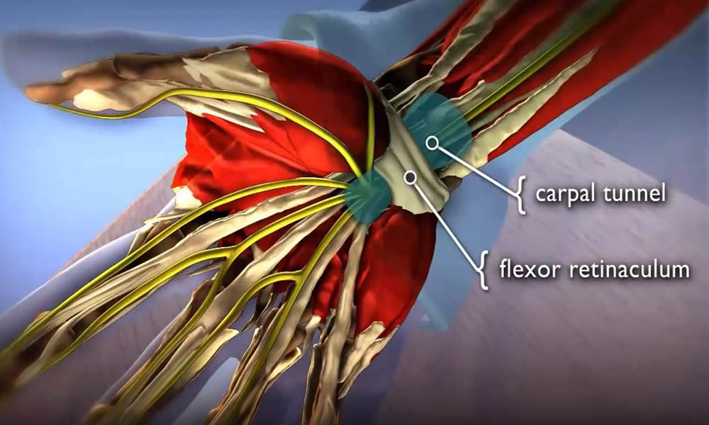 Carpal Tunnel Syndrome Animation - OrthoInfo -AAOS