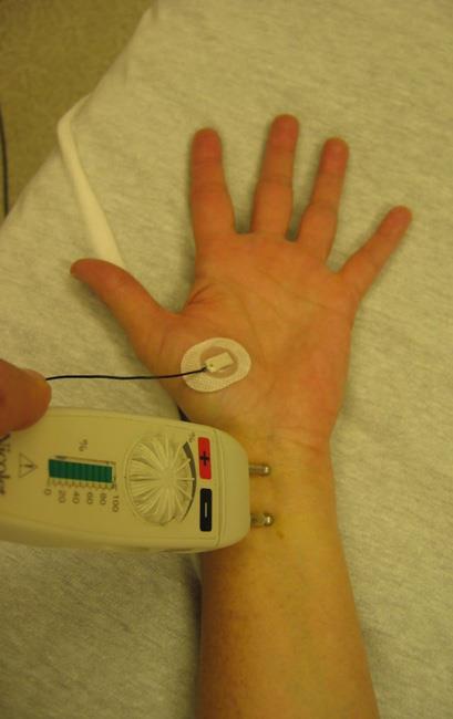 Electromyogram (EMG) test