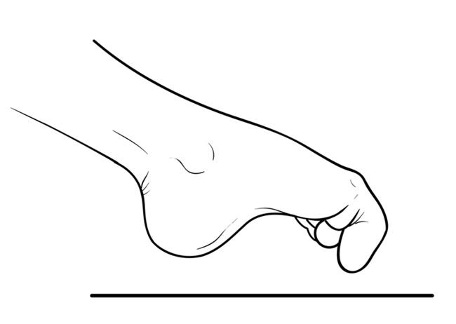 Marble pick-up exercise for foot