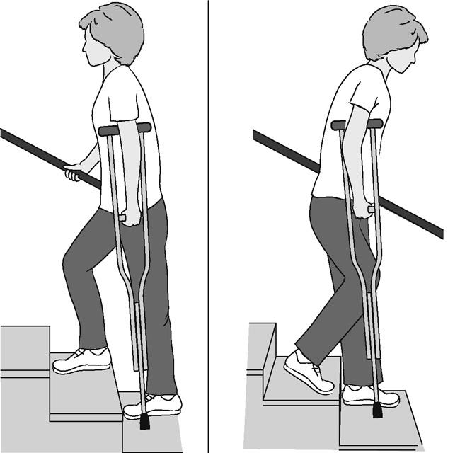 Illustration of woman climbing and descending stairs using a crutch