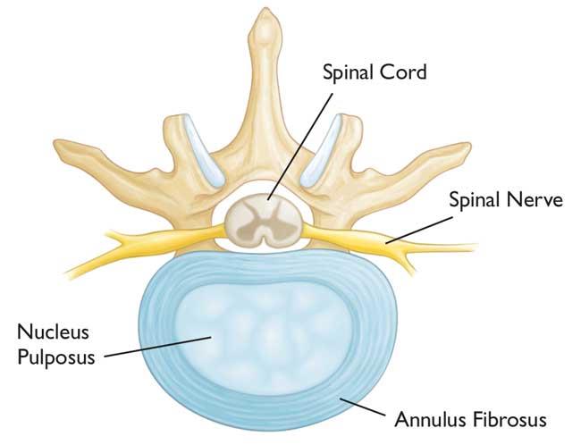 Illustration of an intervertebral disc