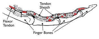 Tendon sheaths