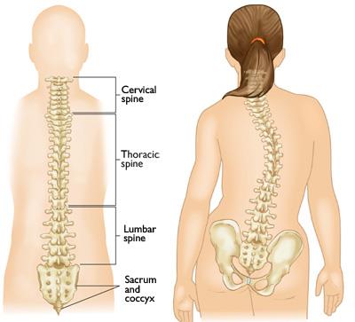 Illustrations of a normal spine and a spine with scoliosis