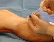 Needle biopsy