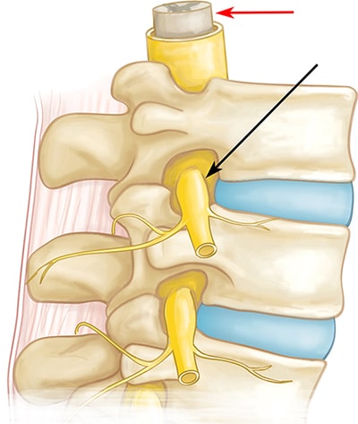 Illustration of spinal nerve root