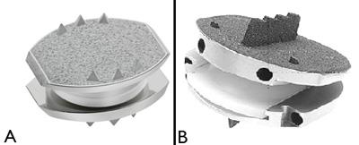 Examples of artificial disk replacements
