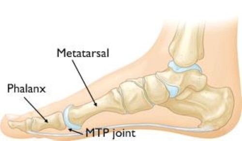 MTP joint anatomy